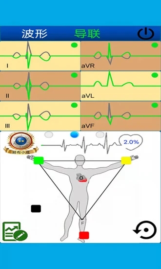 心电图计算器截图